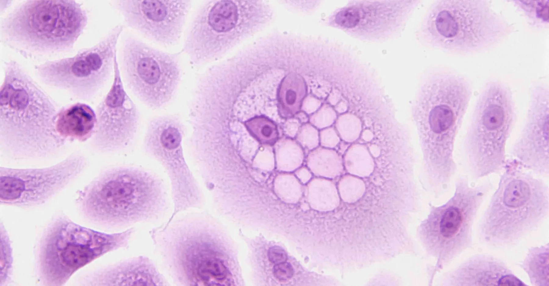 Classifying Gene Mutations